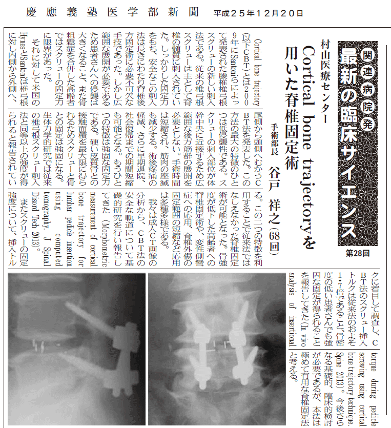 Cortical bone trajectory